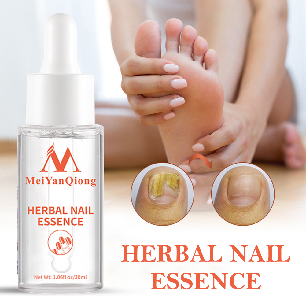 Voetverzorgingsgel Anti-nagelb - Mens Grooming Treatment recensie en prijs
